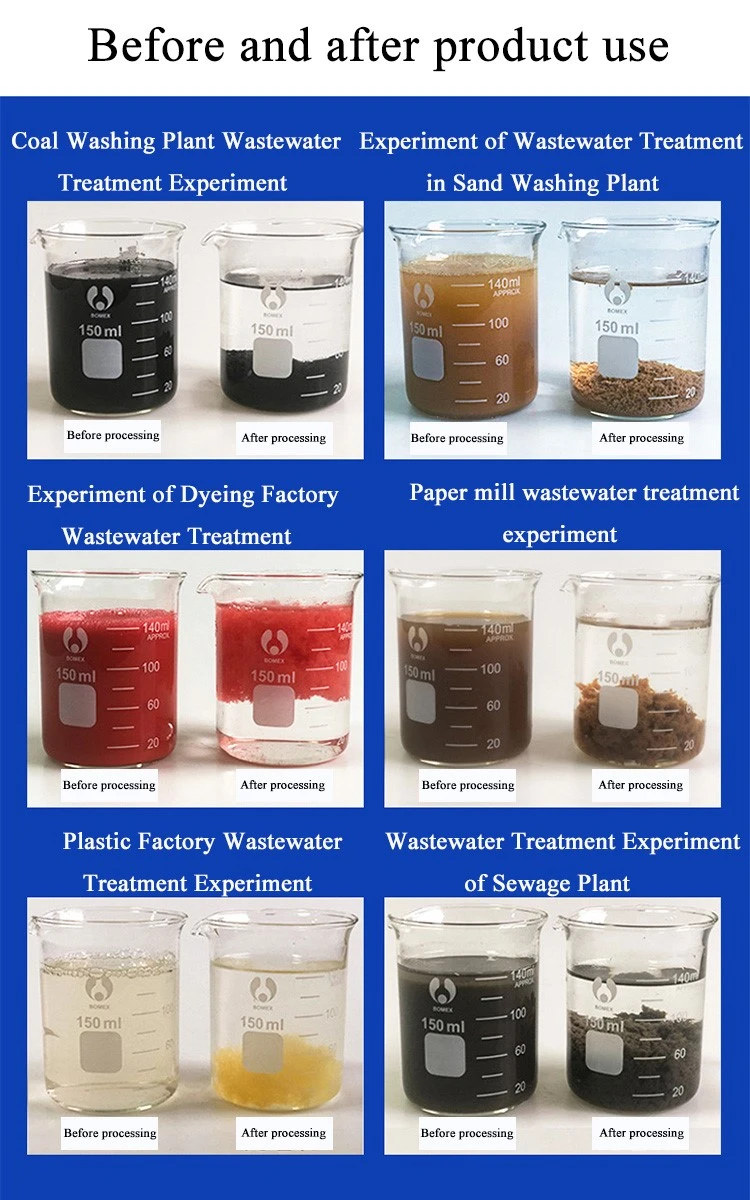 White Granule Powder Anionic PAM Polyacrylamide (3)
